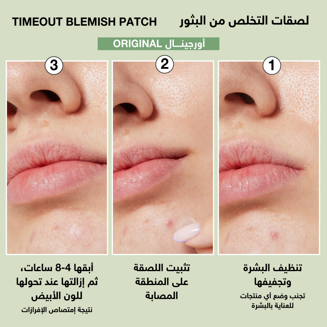 I Dew Care Timeout Blemish Patch Original