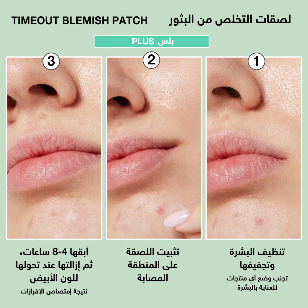 I Dew Care Timeout Blemish Patch Plus